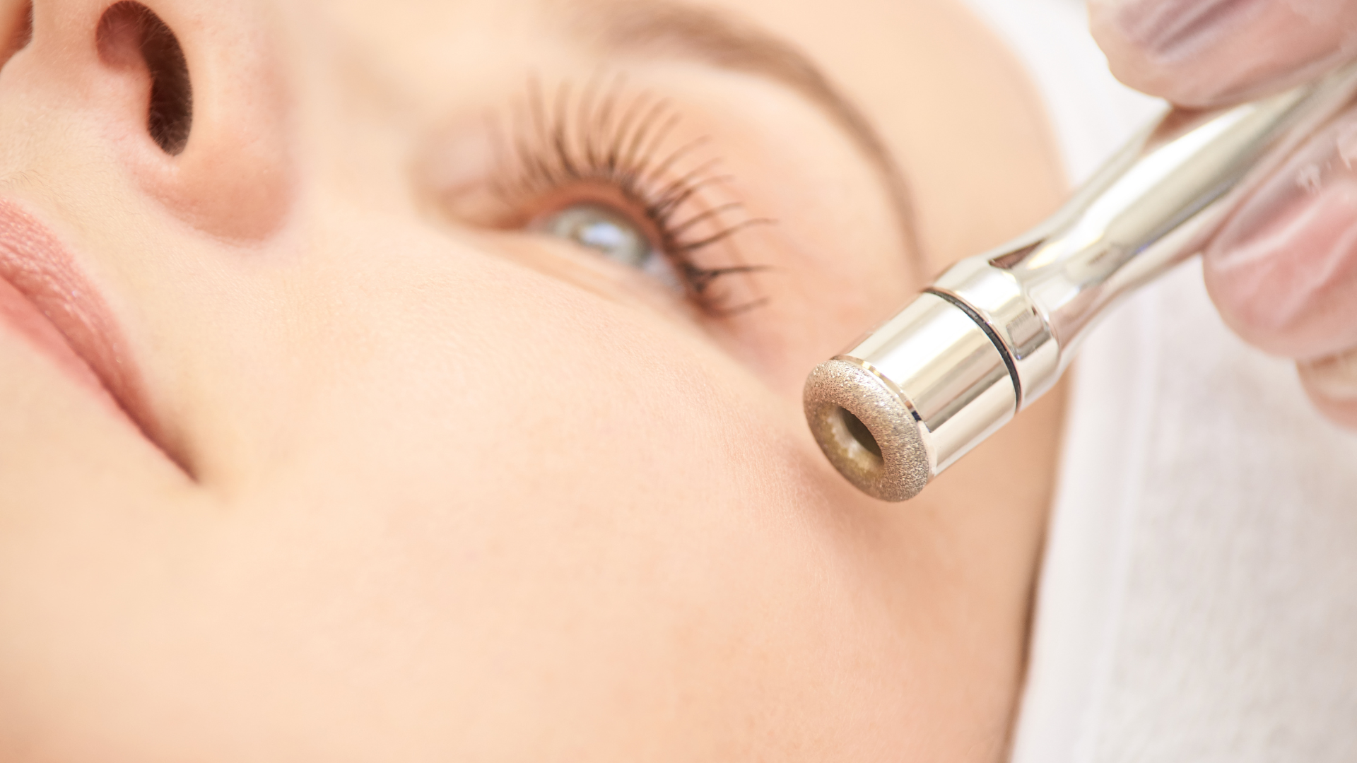 Nahaufnahme vom Gesicht mit Mikrodermabrasionshandstück auf der Haut